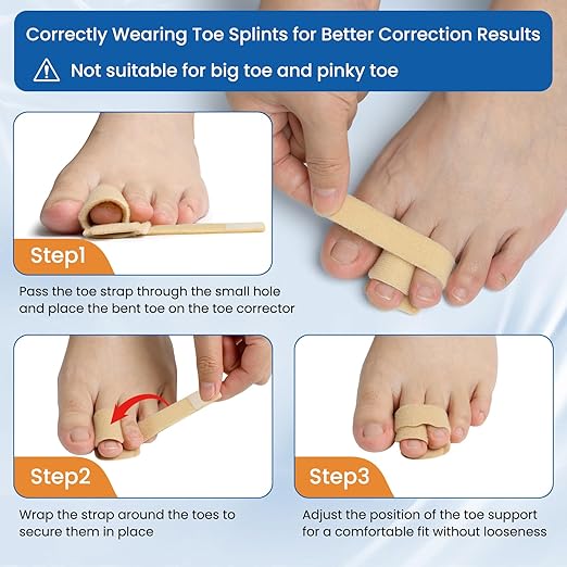 Hyggear™ Hammer Toe Straightener Splint Brace - For Men and Women