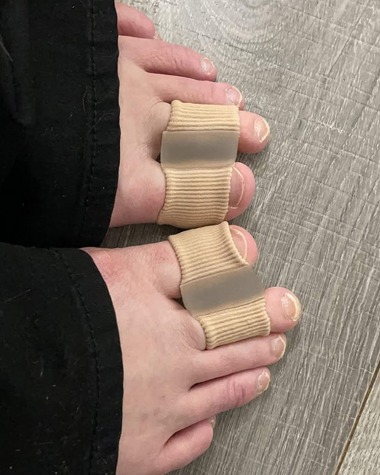 HYGGEAR Big Toe Bunion [Hallux Valgus] Aligner